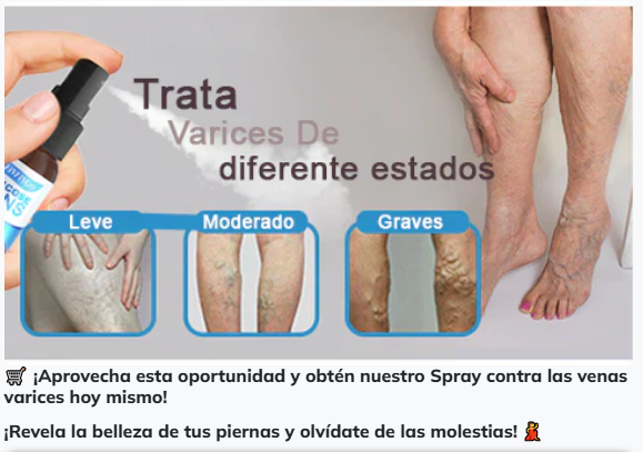 Spray Venas Varices (120ML) + Splash Relajante (60ML)