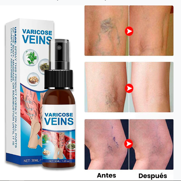 Spray Venas Varices (120ML) + Splash Relajante (60ML)