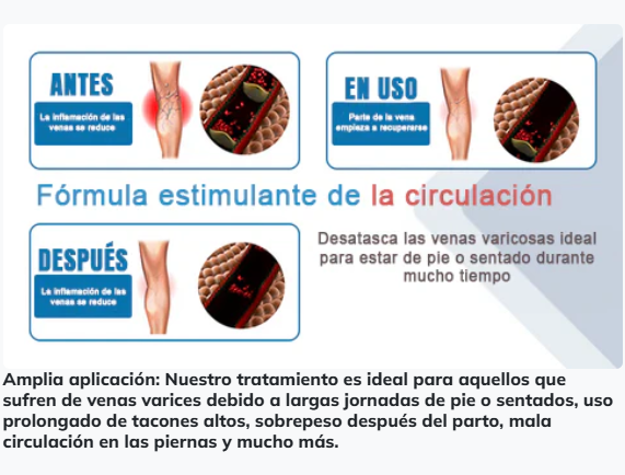 Spray Venas Varices (120ML) + Splash Relajante (60ML)